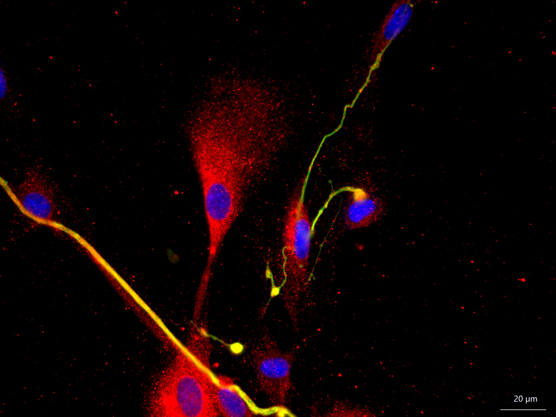 Myelination of spinal rat neurons